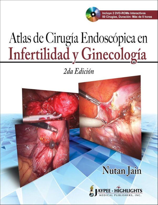 Atlas de Cirugía Endoscópica en Infertilidad y Ginecología
