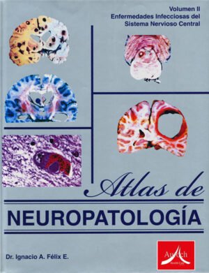 ATLAS DE NEUROPATOLOGIA Vol II_PASTA SUAVE GRIS ATLAS DE NEUROPATOLOGIA Vol. I