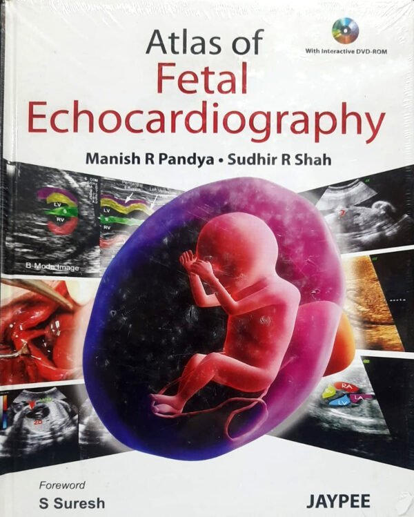 Atlas of Fetal Echocardiography