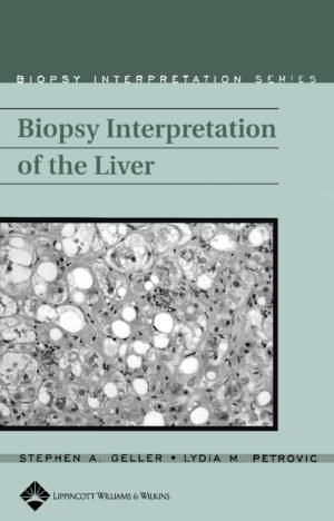 BIOPSY INTERPRETATION OF THE LIVER