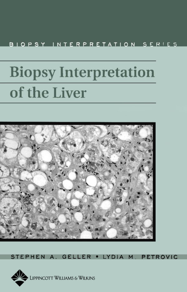 BIOPSY INTERPRETATION OF THE LIVER