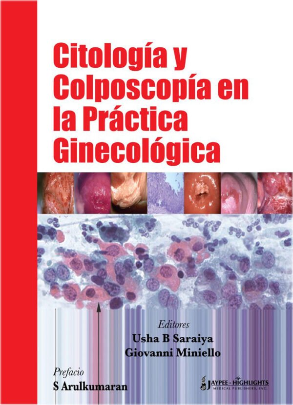 Citología y Colposcopia en la práctica Ginecológica