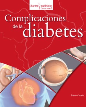 COMPLICACIONES DE LA DIABETES