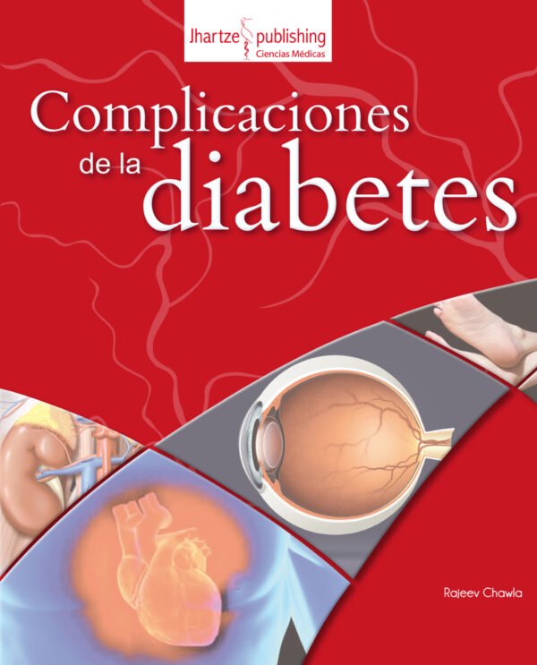 COMPLICACIONES DE LA DIABETES