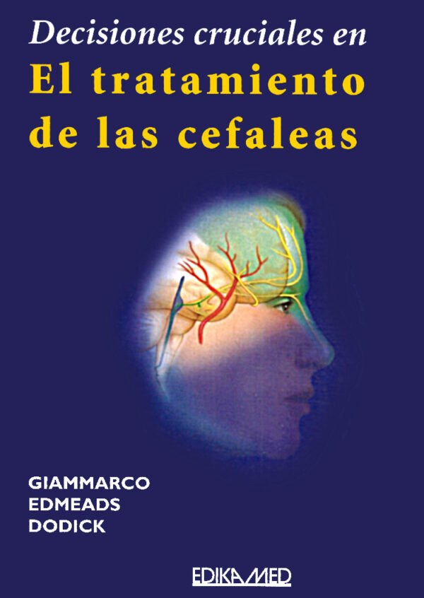 Decisiones cruciales en el trat. de las cefaleas
