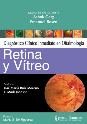 Version 1.0.0 DIAGNÓSTICO CLÍNICO INMEDIATO EN OFTALMOLOGÍA RETINA