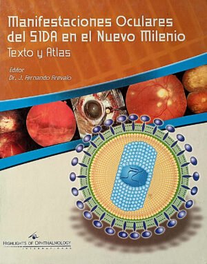 MANIFESTACIONES OCULARES DEL SIDA MANIFESTACIONES OCULARES DEL SIDA