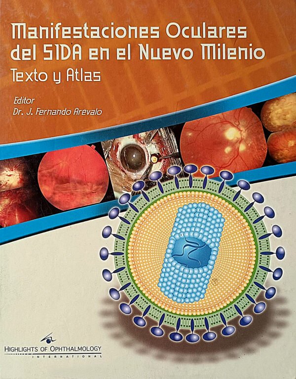 MANIFESTACIONES OCULARES DEL SIDA