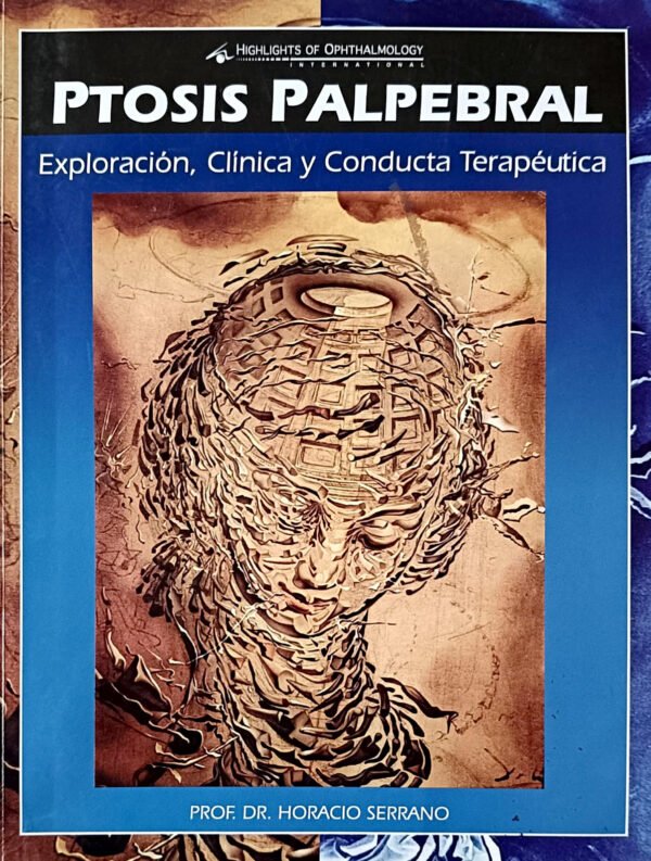 PTOSIS PALPEBRAL - EXPLORACIÓN CLÍNICA