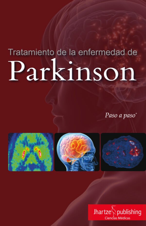 TRATAMIENTO DE LA ENFERMEDAD DEL PARKINSON