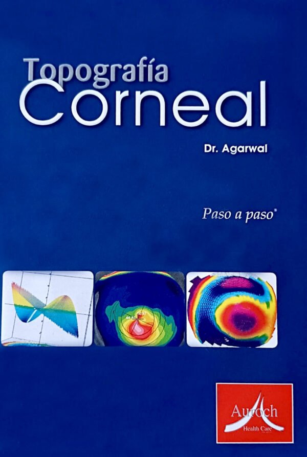 TOPOGRAFIA CORNEAL