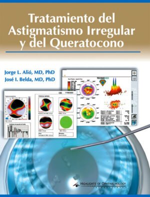TRATAMIENTO DEL ASTIGMATISMO IRREGULAR Y DEL QUERATOCONO